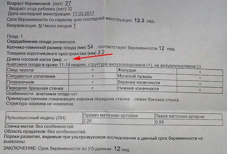 Тест днк беременным. УЗИ 1 скрининг синдром Дауна при беременности. УЗИ первый скрининг синдром Дауна. Синдром Дауна на УЗИ 21 неделя. Генетический анализ при беременности 1 скрининг.