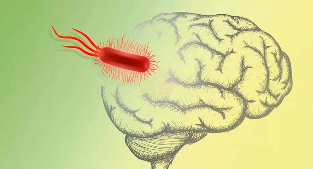 Brain 85. Менингит головного мозга.