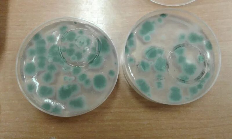 Микрофлора воздуха микробиология. Колонии микроорганизмов в чашке петри. Седиментационный метод питательная среда. Питательные среды для воздуха. Колонии микроорганизмов в чашке петри.