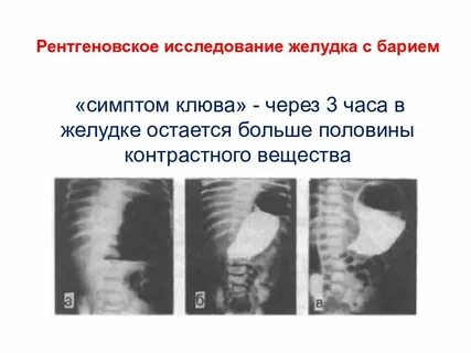 15 рентген
