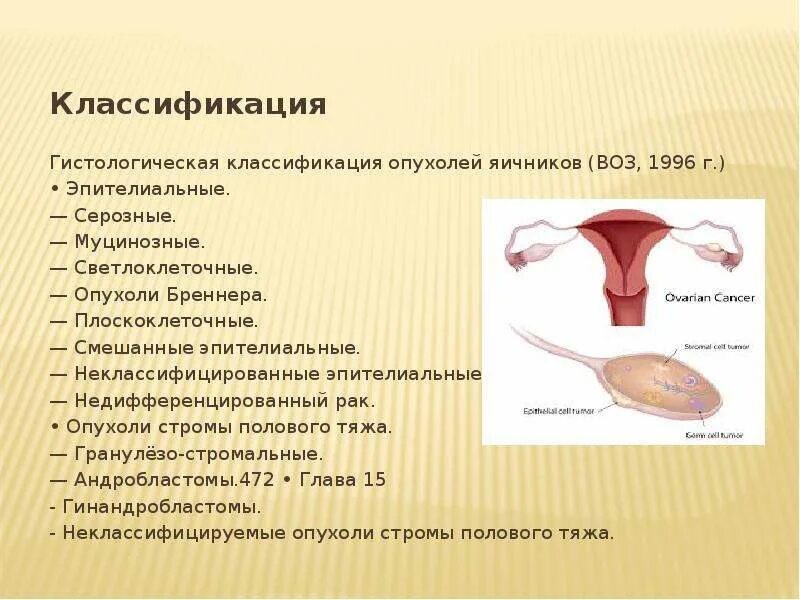 С56 рак яичников. Эпителиальные опухоли яичника. классификация опухолей яичников воз. гистологическая классификация опухолей яичников. злокачественные опухоли яичников классификация.