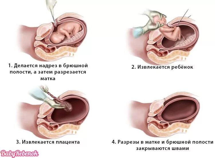 Более 170 работ на тему "Appendix Scars": стоковые фото, картинки и изображения 