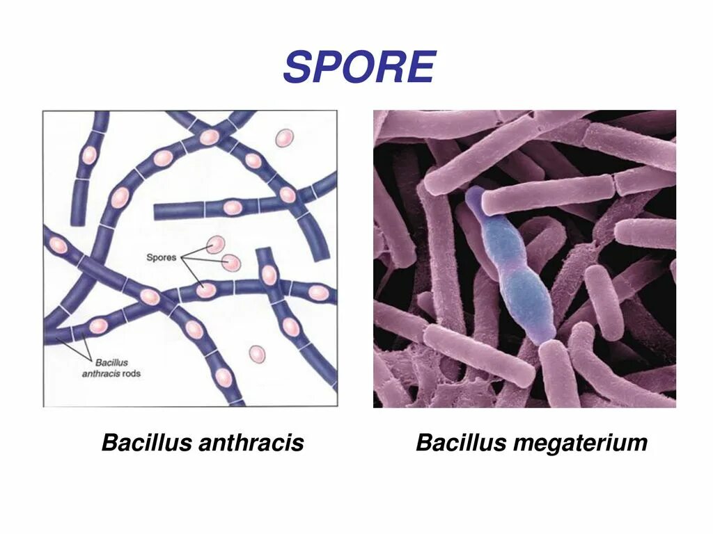 Споры и вегетативные формы. Бацилла антрацис. Бацилла Мегатериум. Bacillus anthracis, а22 (Сибирская язва).