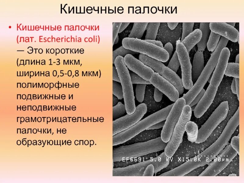 Кишечные палочки какая группа. Кишечная палочка аэроб. Эшерихии группа бактерий. Бактерия кишечная палочка строение. Эшерихии аэробы.