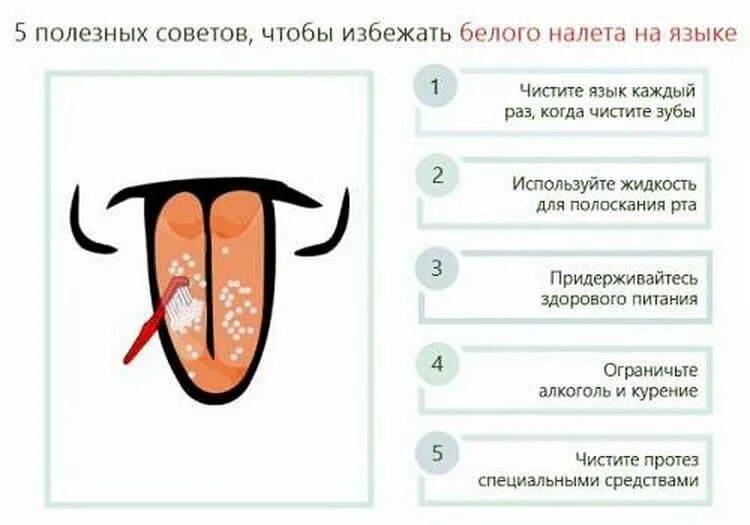 Налет на языке симптомы и болезни. Белый налет на язязыке. Почему сохнет во рту причина что делать