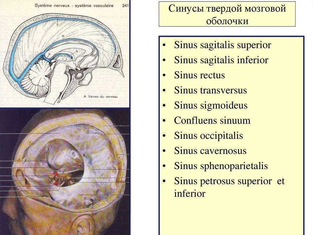 Синусы оболочек головного мозга. Синусы твердой мозговой оболочки топографическая анатомия. Непарные синусы твердой мозговой оболочки. Анастомозы синусов твердой мозговой оболочки. Синусы твердой мозговой оболочки латынь.