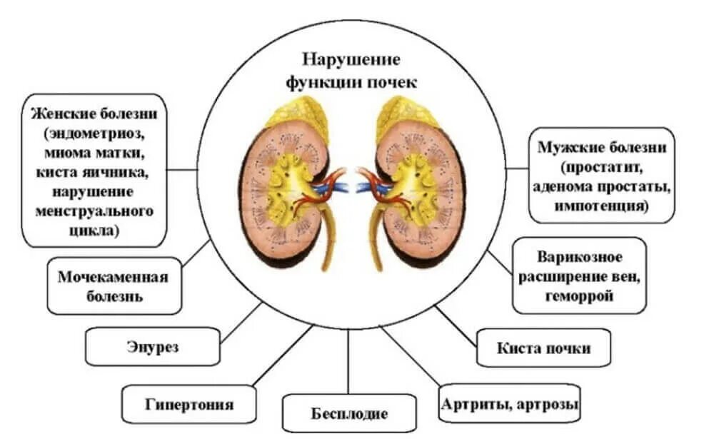 Воспаление почки симптомы и лечение у мужчин. Симптомы болезни почек. Заболевания почек названия. Основные формы заболевания почек.