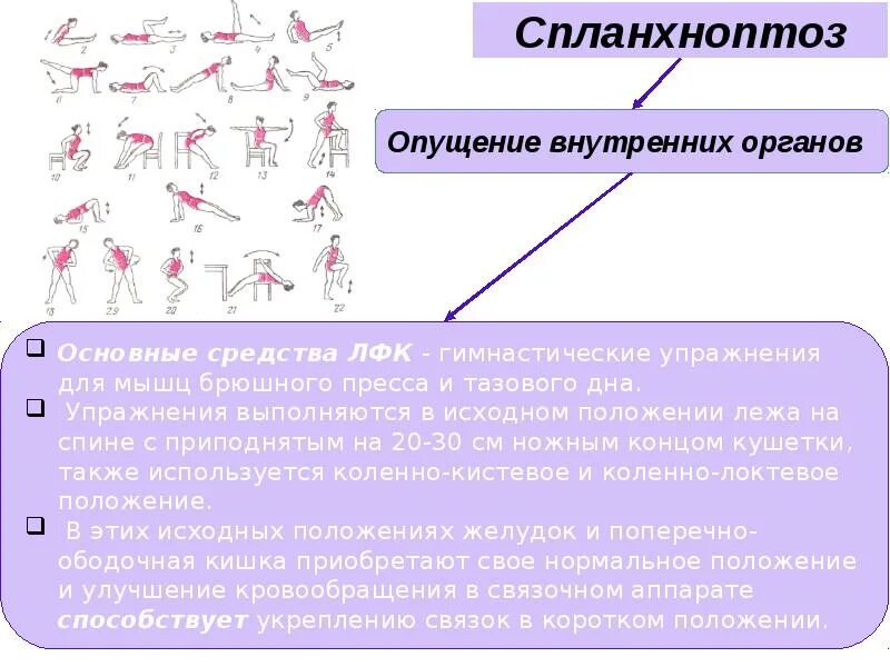 Симптомы висцероптоза. Гастроптоз 1 степени рентген. Опущение кишечника рентген. Презентация малые аномалия развития сердца у детей. Продолжительность курса лечебной физкультуры при спланхноптозе.