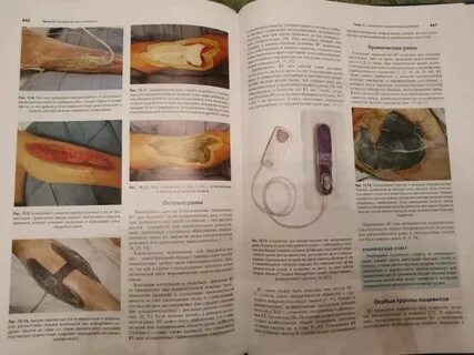 Раны книга