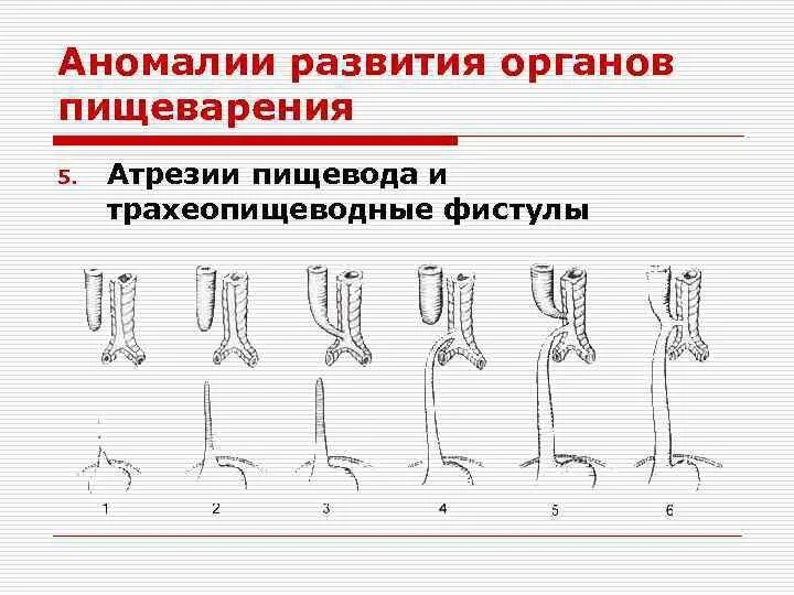 Основные аномалии развития. Онтофилогенетические пороки развития пищеварительной системы. Пороки развития живота и органов пищеварения. Врожденные пороки развития пищеварительной системы. Врожденные пороки развития пищеварительной системы у детей.