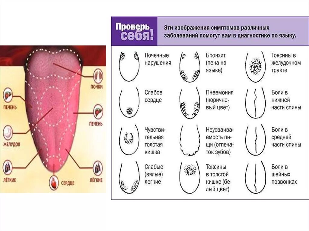 Как определить больной орган. Заболевания по цвету языка. Цвет языка при разных болезнях. Диагностика болезней по языку.