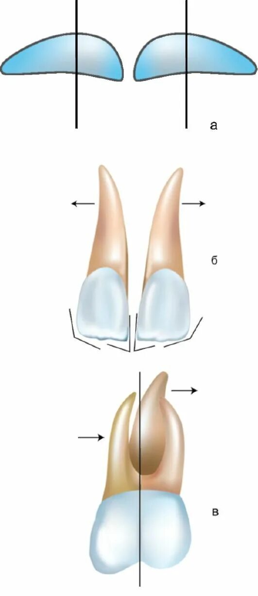 Признак угла коронки. Кривая шпее. Поверхности зуба в стоматологии схема. Зубы углом. Характеристика прикуса.