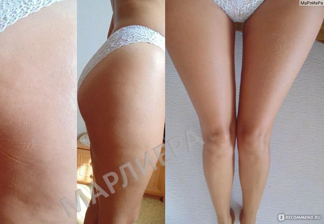 Растяжка до и после отзывы Pinterest