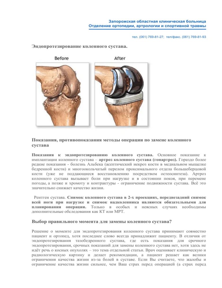 Форум после эндопротезирования коленного сустава. Предоперационное планирование эндопротезирования коленного сустава. подагра коленного сустава эндопротезирование. эндопротезирование коленного сустава шов. эндопротезирование коленного сустава клинические рекомендации.