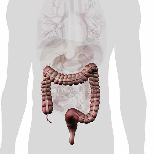 How to Tell the Difference Between IBS and IBD