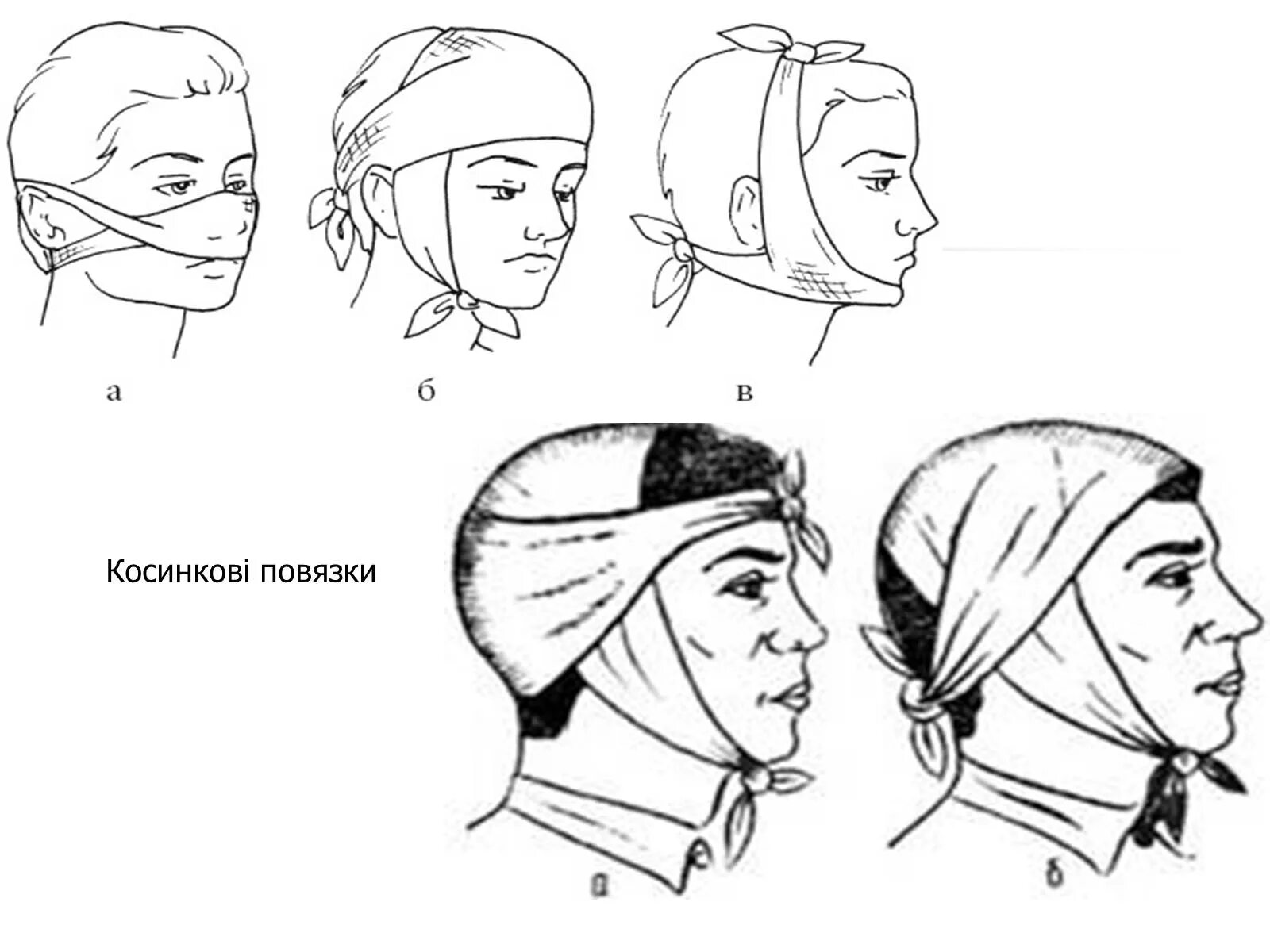 Повязка на голову размеры. Наложение косыночной повязки на голову. Пращевидная повязка по Гиппократу. Косыночная повязка на затылок. Пращевидная повязка на затылок.