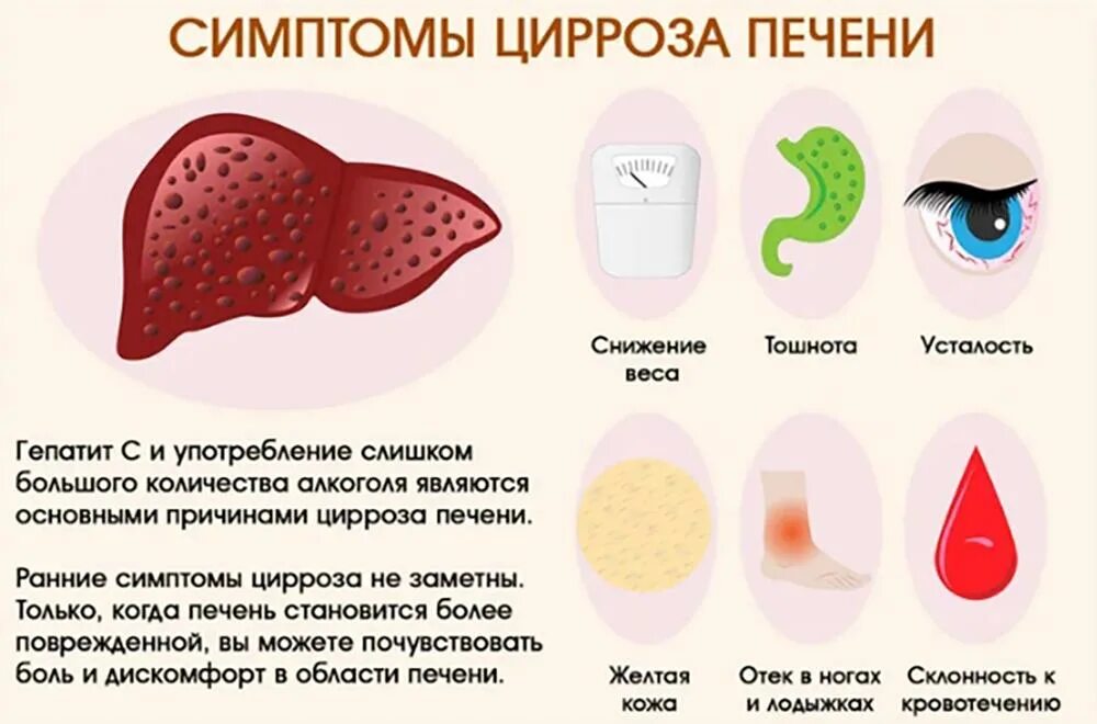 Заболевание печен. Печеночные проявления цирроза печени. Ранние признаки цирроза печени. Проблемы с печенью симптомы. Цеэрос печени симптомы.