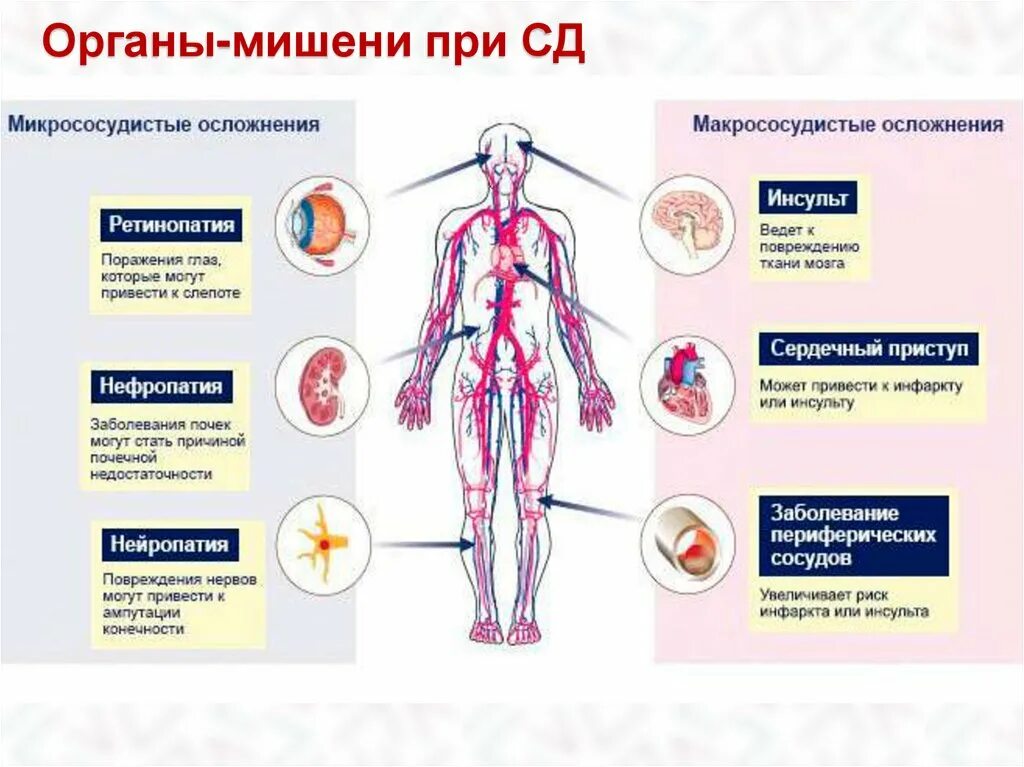 Диабет без осложнений. Поздние осложнения сахарного диабета 2 типа. Сахарный диабет органы мишени. Поздние осложнения СД 2 типа. Органы мишени сахарного диабета 1 типа.