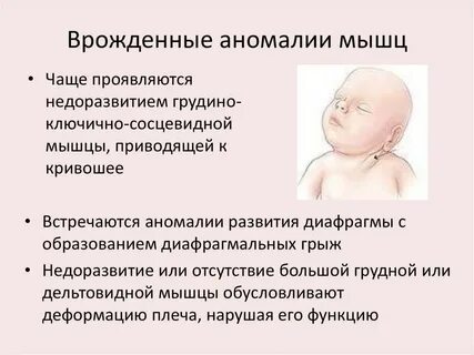 Врожденные синдромы
