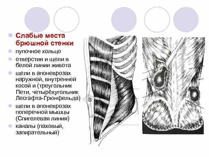 Белая линия живота пупочное кольцо. Послеоперационная грыжа грыжа белой линии. Белая линия живота пупочное кольцо. Строение белой линии живота и пупочного кольца. Зона четырехугольник грюнфельда-лесгафта.