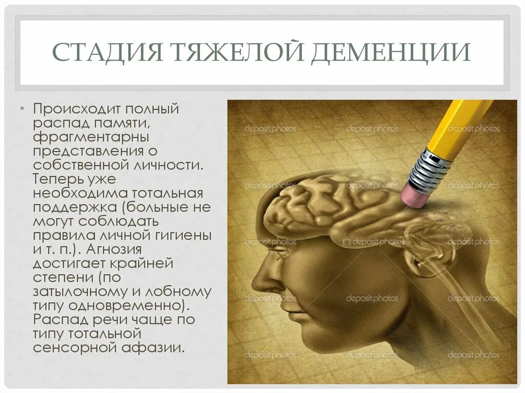 Стадии деменции у пожилых. Деменция. деменция тяжелой степени. тяжелая стадия деменции. деменция презентация.