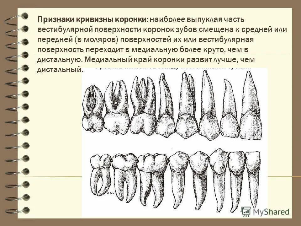 Изгиб зубов. Вестибулярная поверхность коронки первого верхнего резца. Премоляр 1 вестибулярная поверхность. Моляр премоляр резец. Зубы верхняя челюсть вестибулярная поверхность.