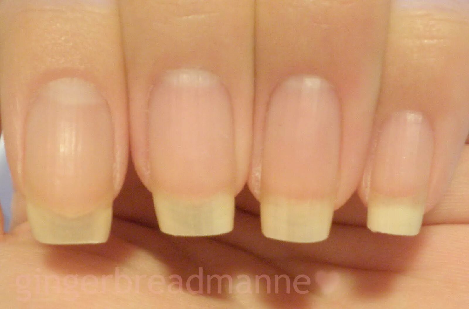 Ногти без маникюра. Неправильная форма ногтей на руках. Почему ногти квадратные. Название форм ногтей при наращивании. Продольно морщинистая кутикула.