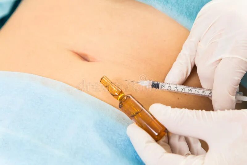 Инъекционный липолиз. Lipolysis липолитик. Акваликс липолитик до и после. Липолитики для коррекции фигуры. Мезотерапия тела.