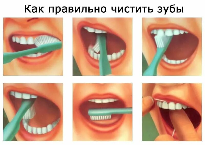 Как чистить зубы то. Как правильно чистить зубы. как правильно чисть зубы.