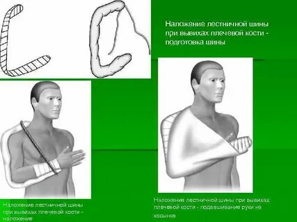 Лестничная шина