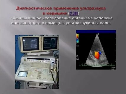 4 ультразвуковые методы