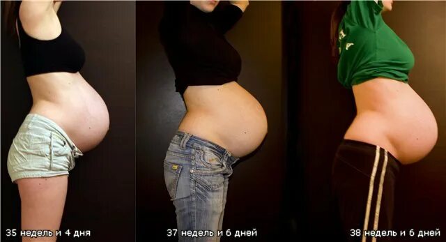 Опущение живота перед родами. Опущенный живот у беременных. Опущенный живот перед родами.