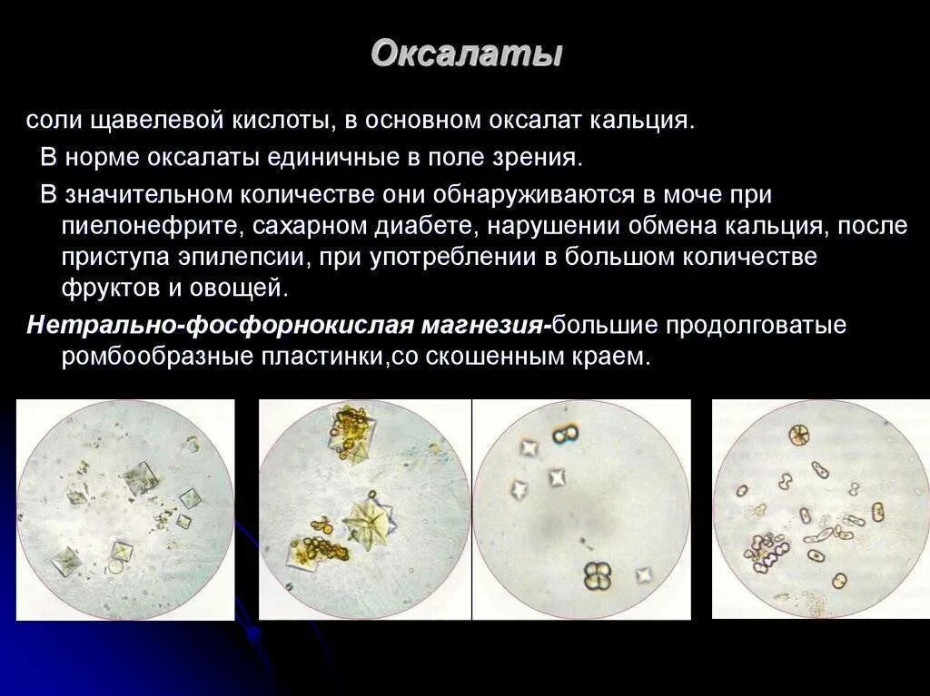 Кристаллы оксалата в моче у мужчин