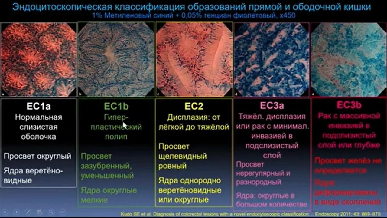 Синдром мэллори-вейса форрест 2с. Endoexpert логотип. Эндоэксперт классификации. Kudo эндоскопия классификация. Эндоэксперт.