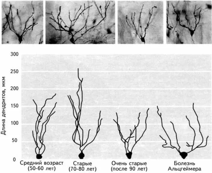 Возрастные изменения головного мозга. Возрастные изменения нейронов. Возрастные изменения нейронов кратко. Количество нейронов у человека с возрастом.