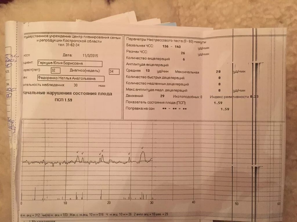 Ктг псп 0,40. Направление на ктг. Индекс реактивности ктг норма. Индекс реактивности ктг норма. Ктг псп норма.