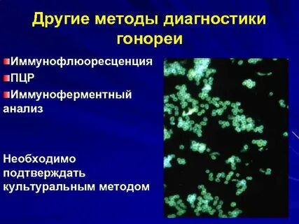 Лабораторная диагностика гонококков