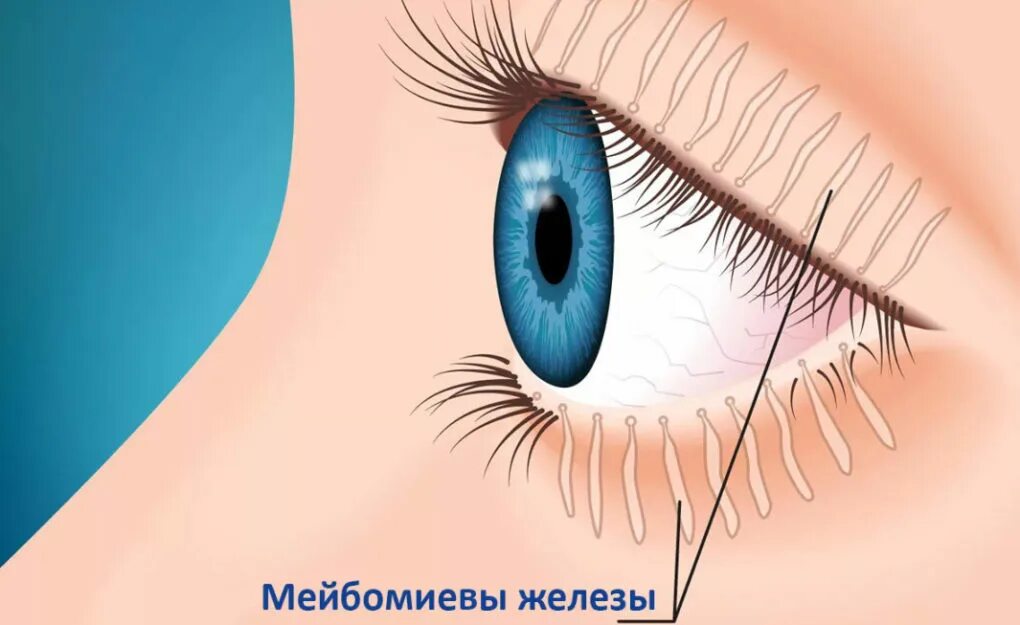 Дисфункция мейбомиевых желез блефарит. Мейбомиевые железы глаза. Блефарит конъюнктивит ячмень.