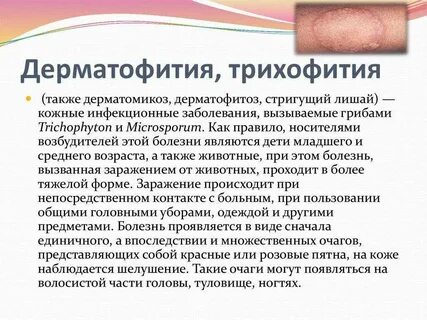Как лечить болезнь кожи