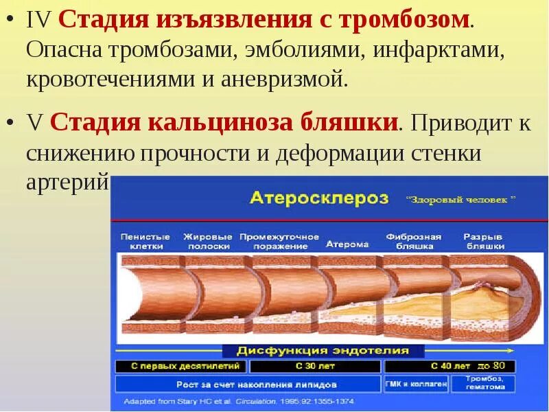 Этапы образования тромбоза. Стадии тромбообразования. Стадии образования тромба. Стадия изъязвления бляшки. Степени тромбоза