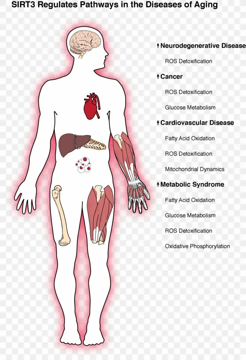 Associated diseases. Болезнь связанная с костями. The metabolic Syndrome. Cancer diseases PNG. Diseases associated