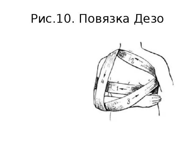 Как одеть повязку дезо. Как одеть повязку дезо