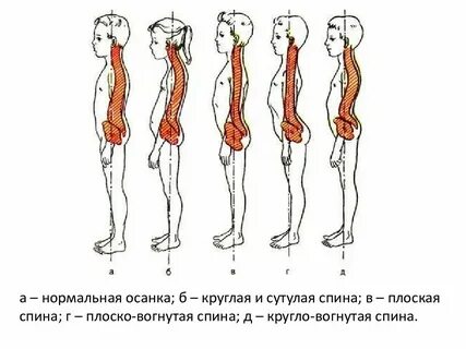 Осанка спины