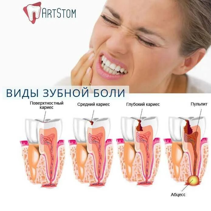 Ломит зубы причины и лечение