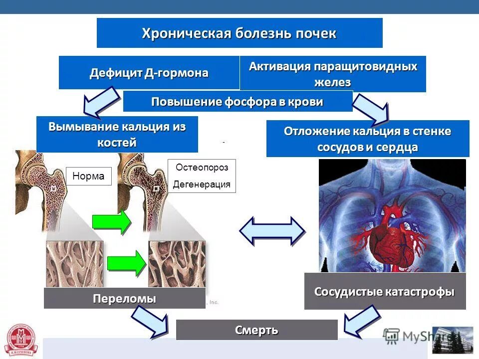 остеопороз кальций фосфор. остеопороз кальций фосфор. исследования при остеопорозе. лабораторные показатели при остеопорозе. остеопороз кальций фосфор.