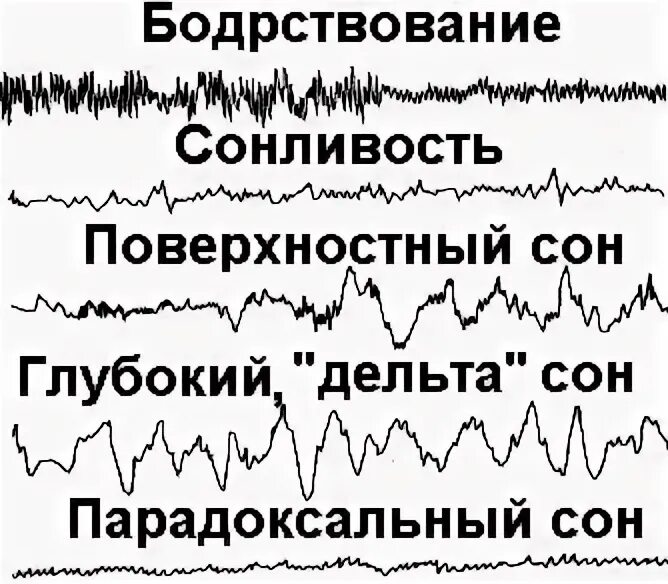 Ээг бодрствования. Электрическая активность мозга. Активность мозга во сне. Активность мозга во время сна.