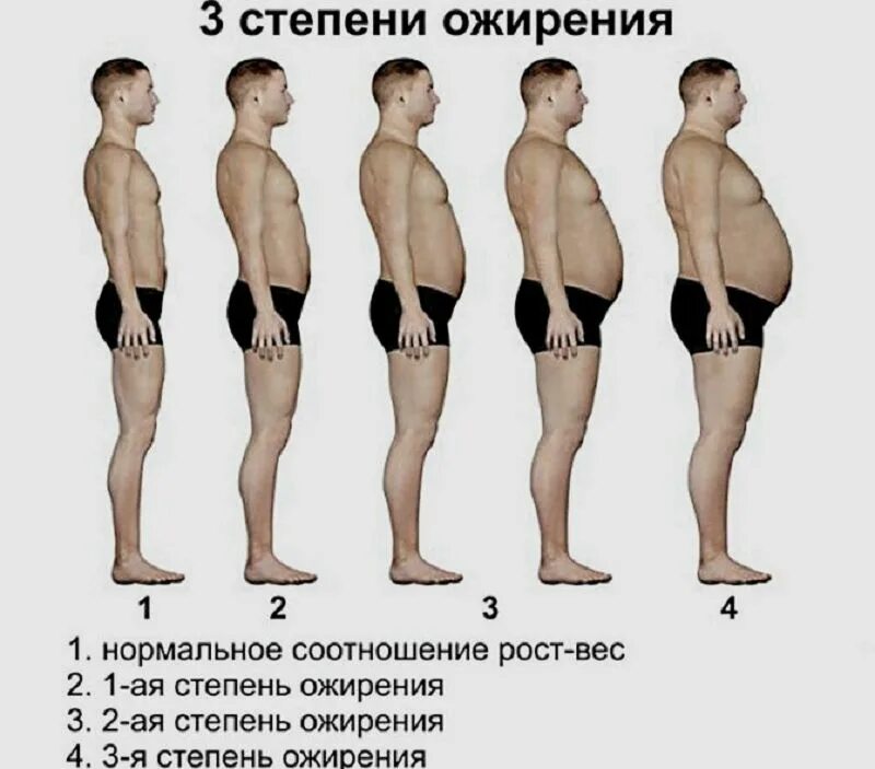 Типы живота