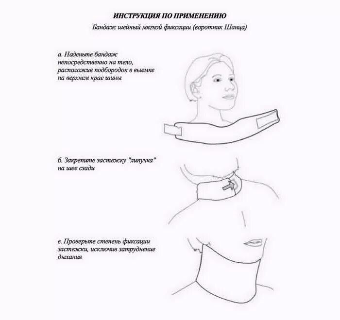 Можно спать в воротнике шанца. Воротник Шанца при шейном у новорожденных. Воротник Шанца не применяется. Воротник Шанца не применяется при. Воротник Шанца показания.