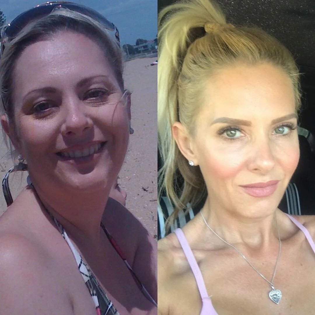 жизнь после сорока. изменили жизнь в 40 лет. изменили жизнь в 40 лет. мужчина и женщина средних лет. лицо до и после отказа от алкоголя.