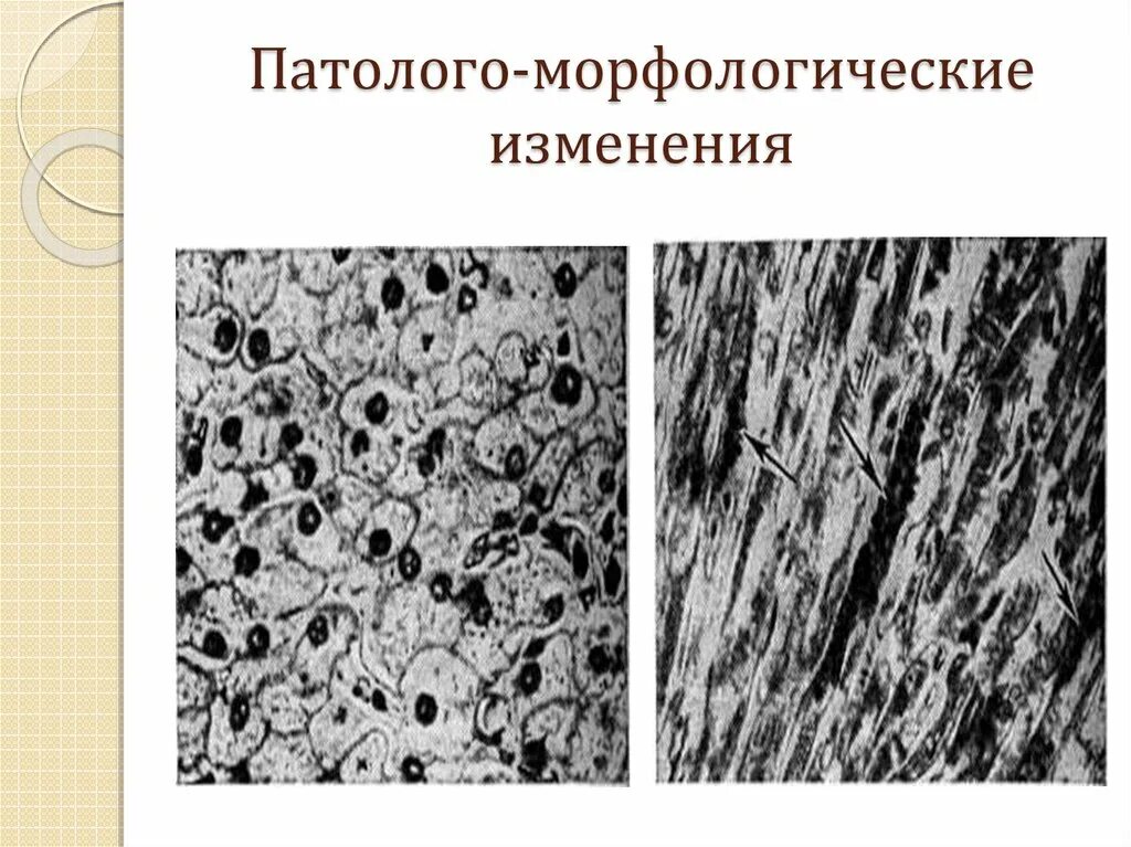 Изменения в морфологической системе. Морфологические изменения. морфологические изменения организма это. морфологические изменения это в биологии. гликогеновая болезнь типы.